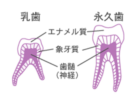 乳歯はエナメル質が薄い